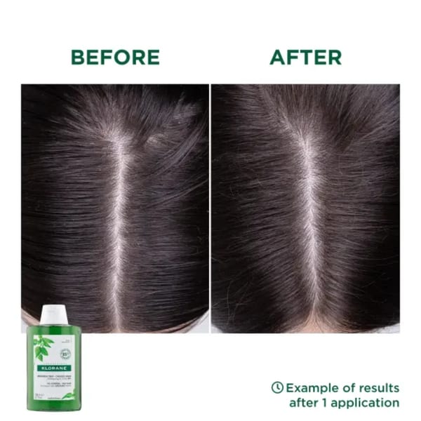 Klorane Oil-Control Shampoo with Nettle - مقاسان