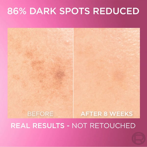 L'Oréal Paris, Glycolic Bright سيروم للوجه، بتركيبة 8% [Melasyl ™ + حمض الجليكوليك + نياسيناميد]، للبقع الداكنة والإشراقة 30مل