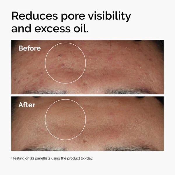 The Ordinary Niacinamide 10% + Zinc 1% Serum للبشرة الدهنية